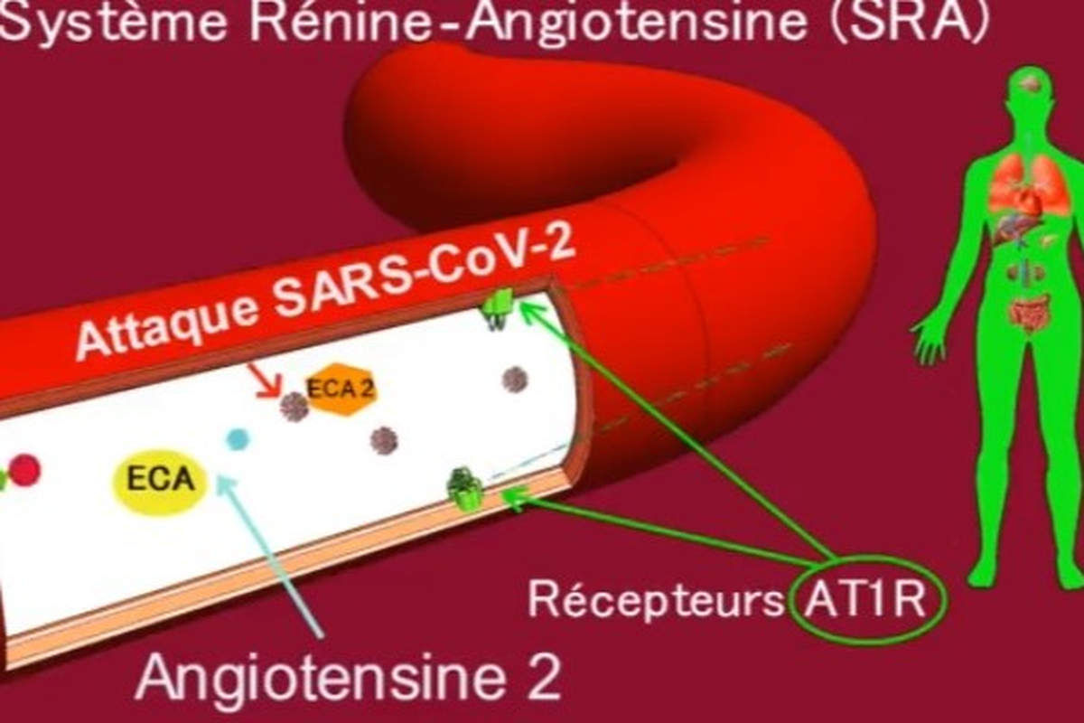 Two drugs to protect Covid-19