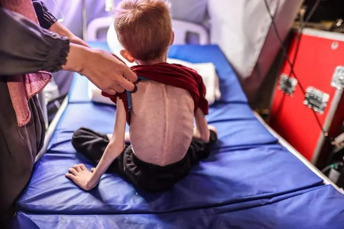 In Gaza, children are dying of hunger (UNRWA)